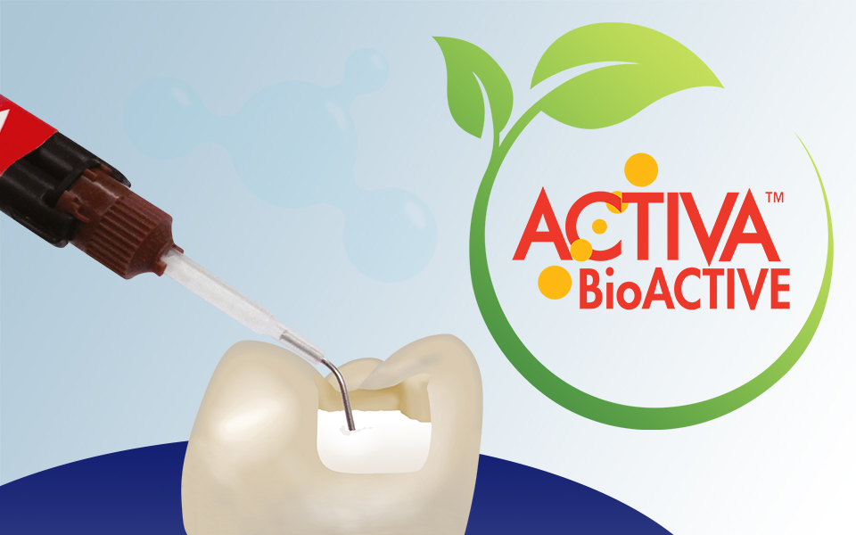 Titelbild Pulpdent Activa BioActive Blogartikel